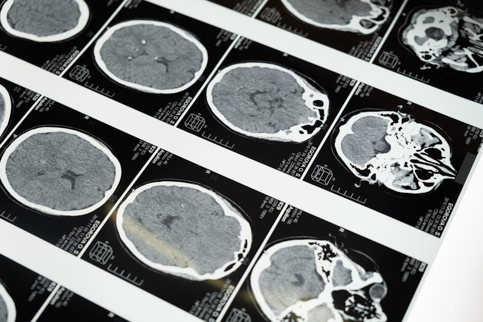 detailed brain mri scans displayed on a lightbox showcasing